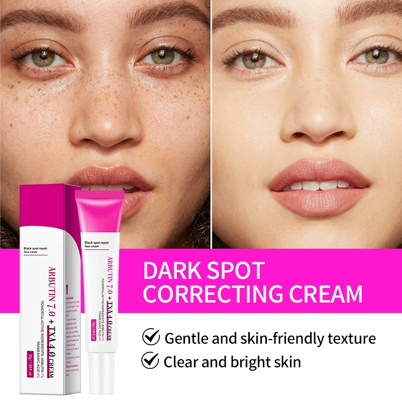 Black Spot Repair Cream Corrective Facial and Body Care Arbutin Aminocaproic Acid Cream